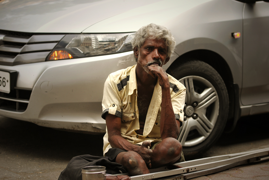 In this photograph we see an Indian man suffering from leprosy on the pavement in Mumbai, India. One of the first noticeable sign of leprosy is often the development of pale or pinkish patches of skin that may be insensitive to temperature or pain and this is sometimes accompanied or preceded by nerve problems including numbness or tenderness in the hands or feet.